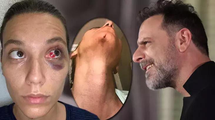 Ozan Güven ve Deniz Bulutsuz'un davasında karar çıktı! 1 yıl 15 ay hapis cezası